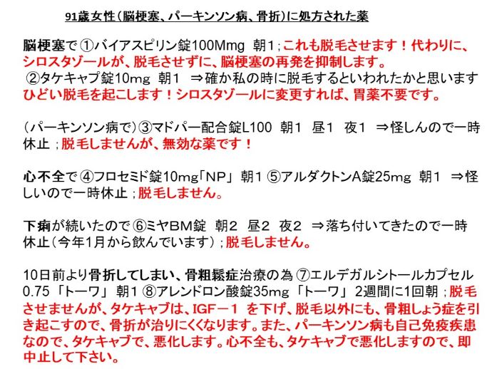 円形脱毛症　病院